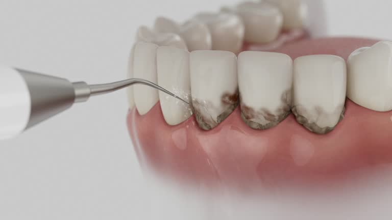 Reliable Dental Implants contractor in Rosamond, CA by Smile Center Dentistry